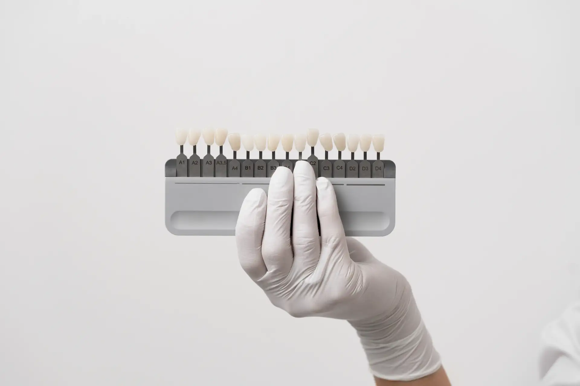 dental-veeners
