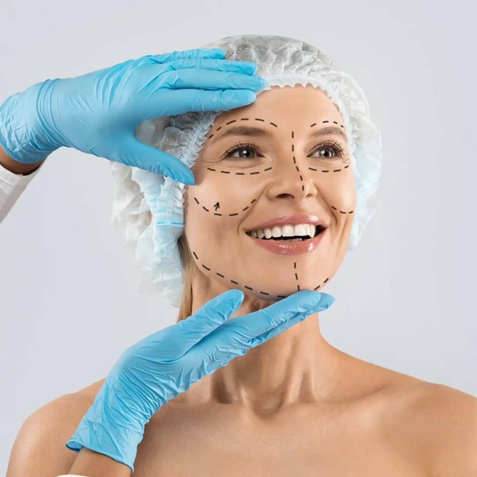 cirurgia de mini-facelift