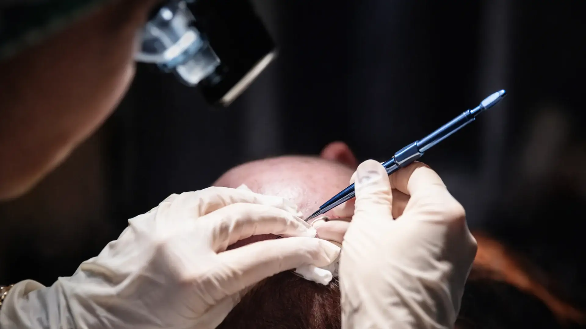 ce-este-safir-fue-transplant-de-par