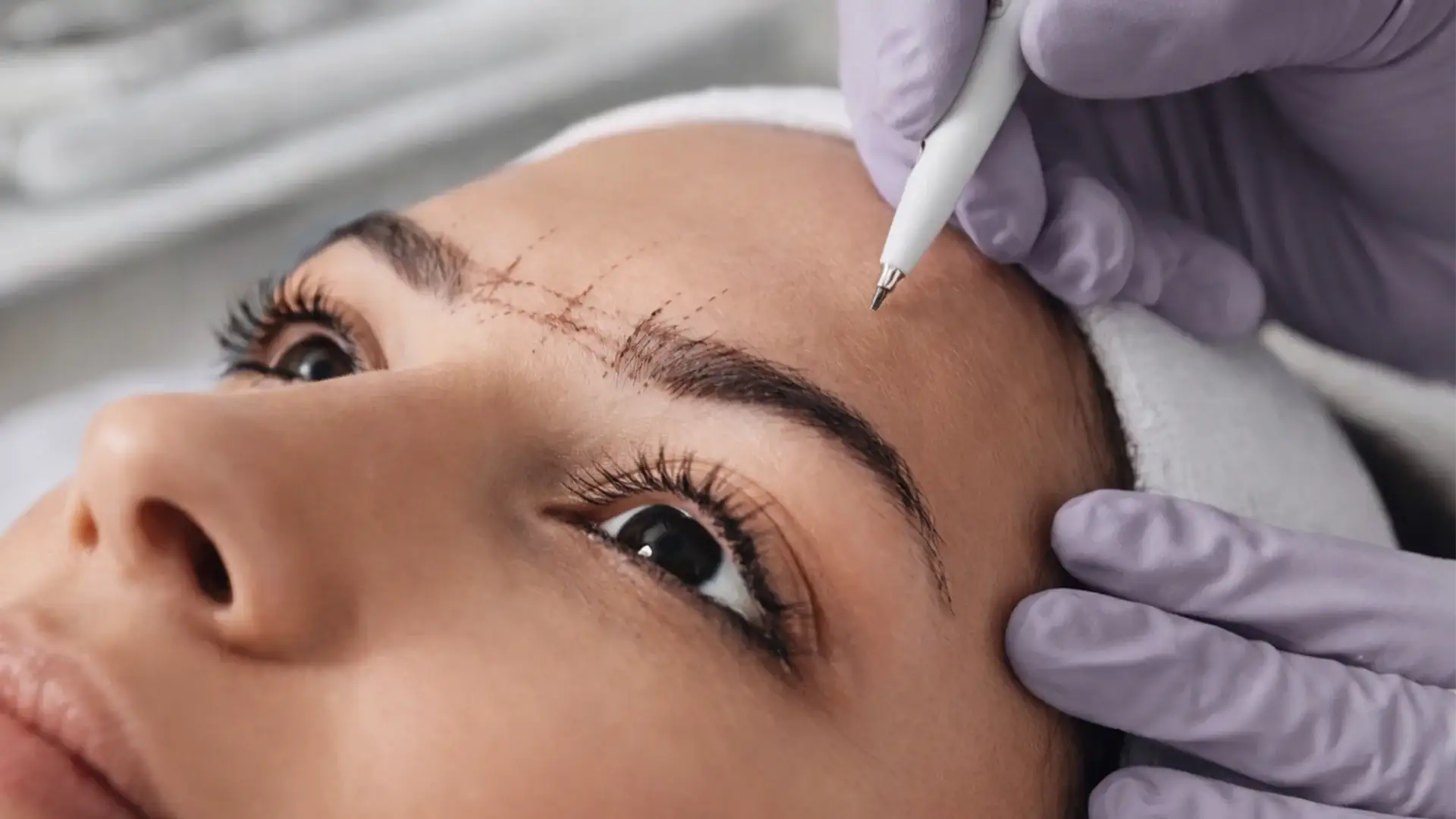 greffe de sourcils