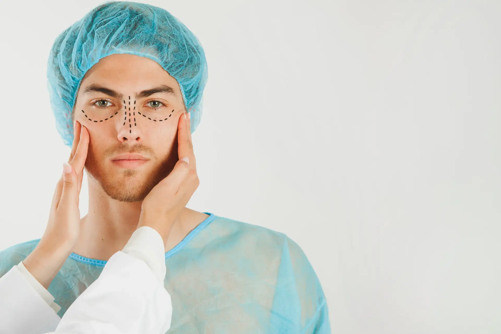 rinoplastia aberta