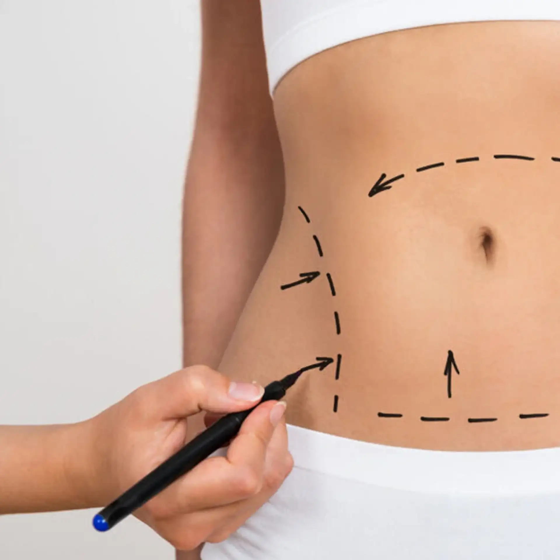 kto-jest-odpowiednim-kandydatem-do-plastyki-brzucha-(abdominoplastyki)-operacji