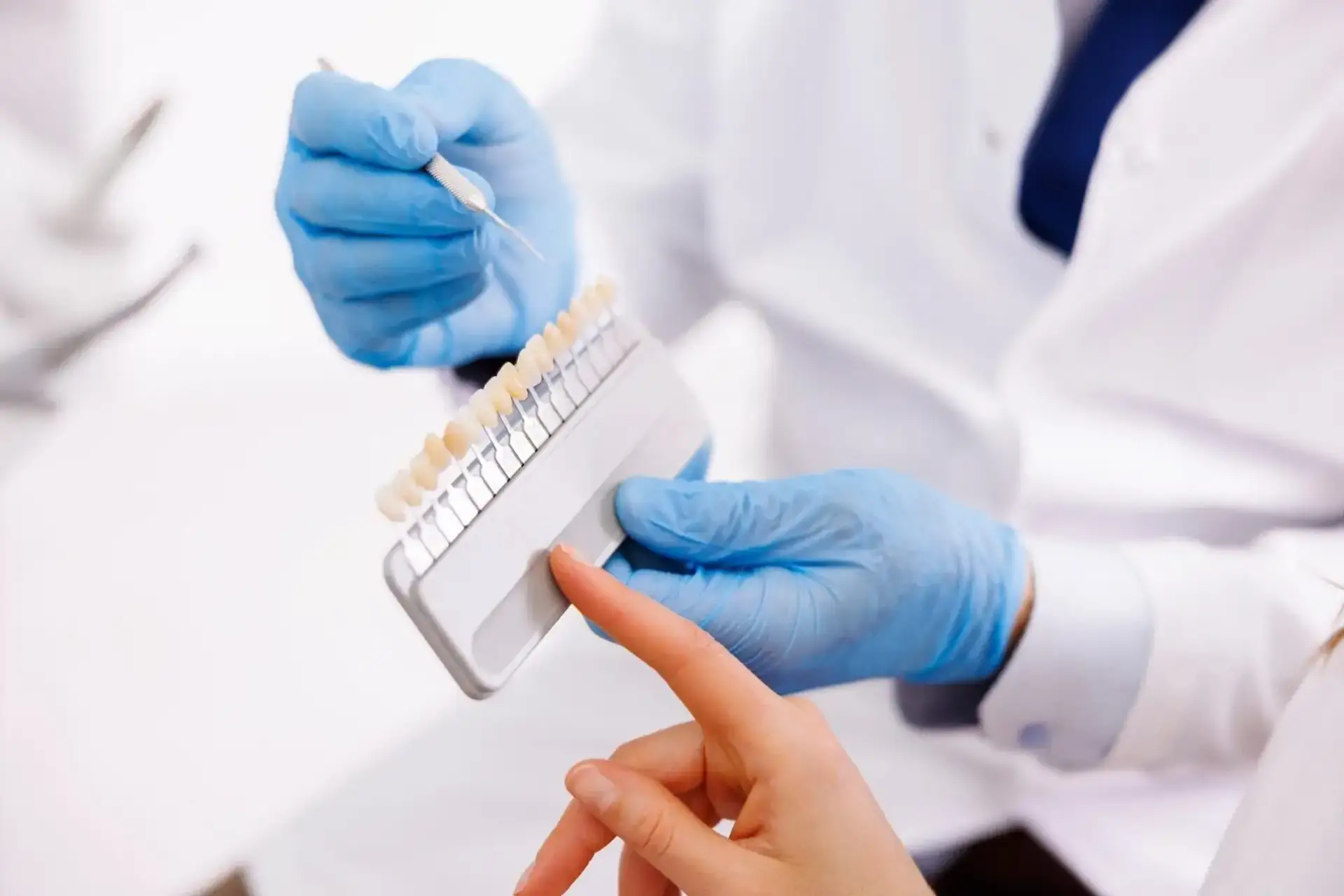dentist-showing-dentail-facets-color-palette-to-patient