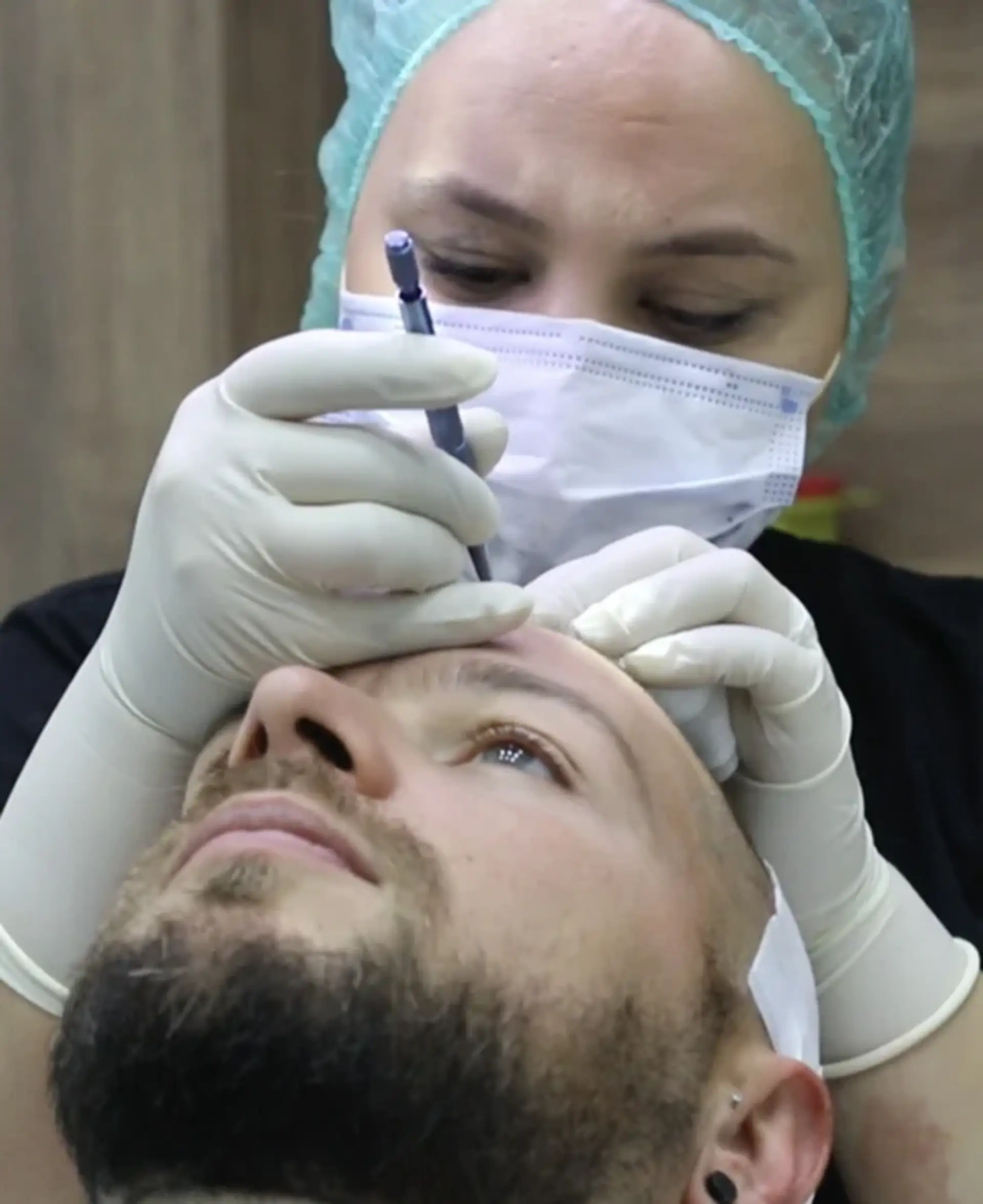 modern-facilities-albania-hair-transplant