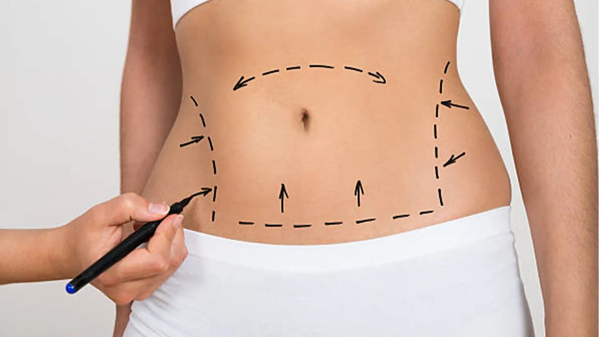 mega-liposukcja-jak-rozpocząć-z-liposukcją-w-turcji
