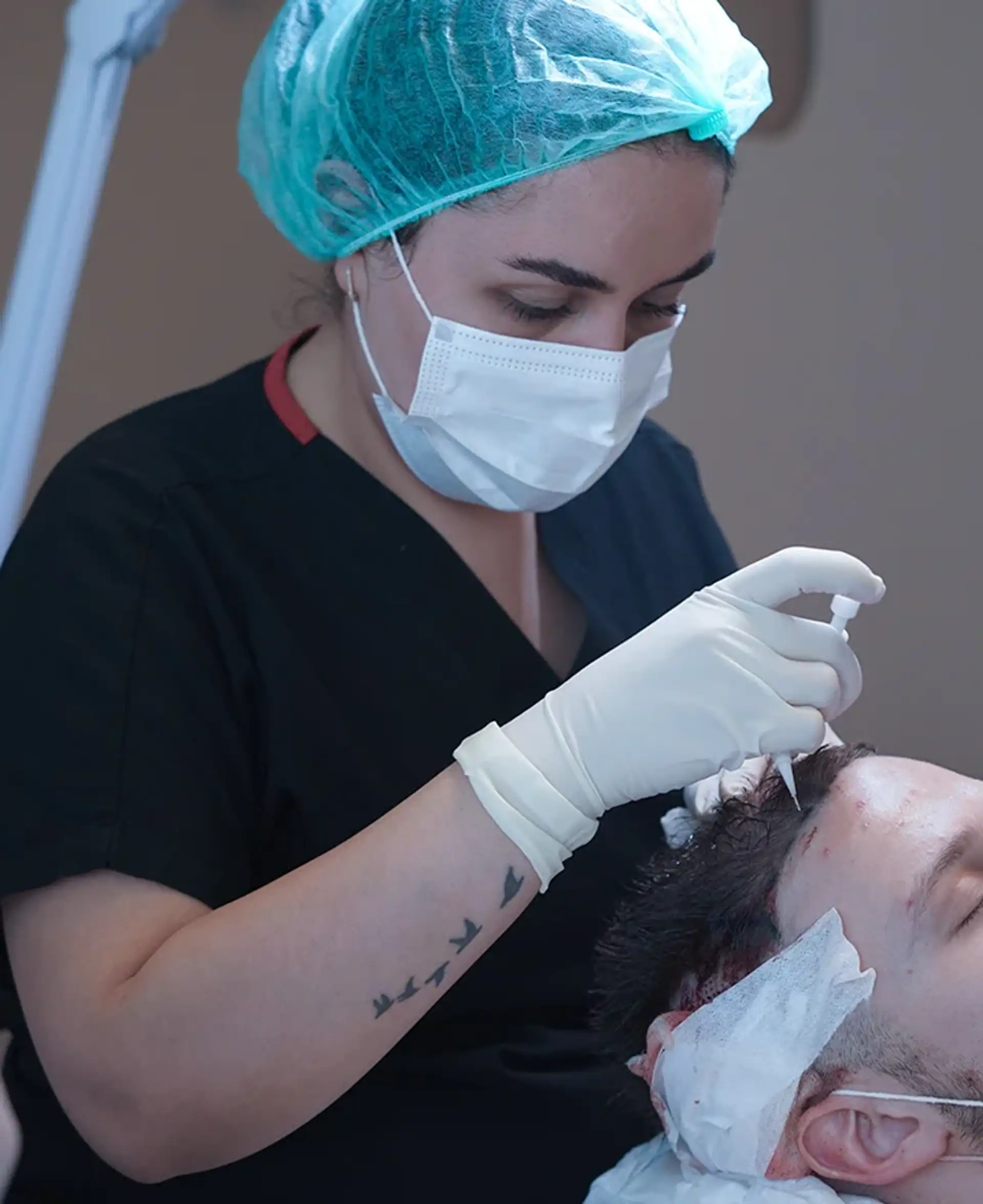 royal-hair-istanbul-hair-transplant