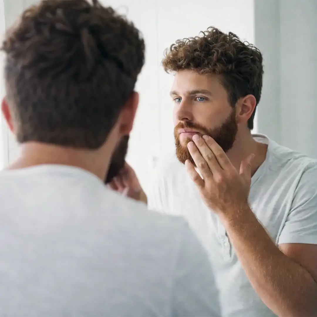 Greffe de poils de barbe