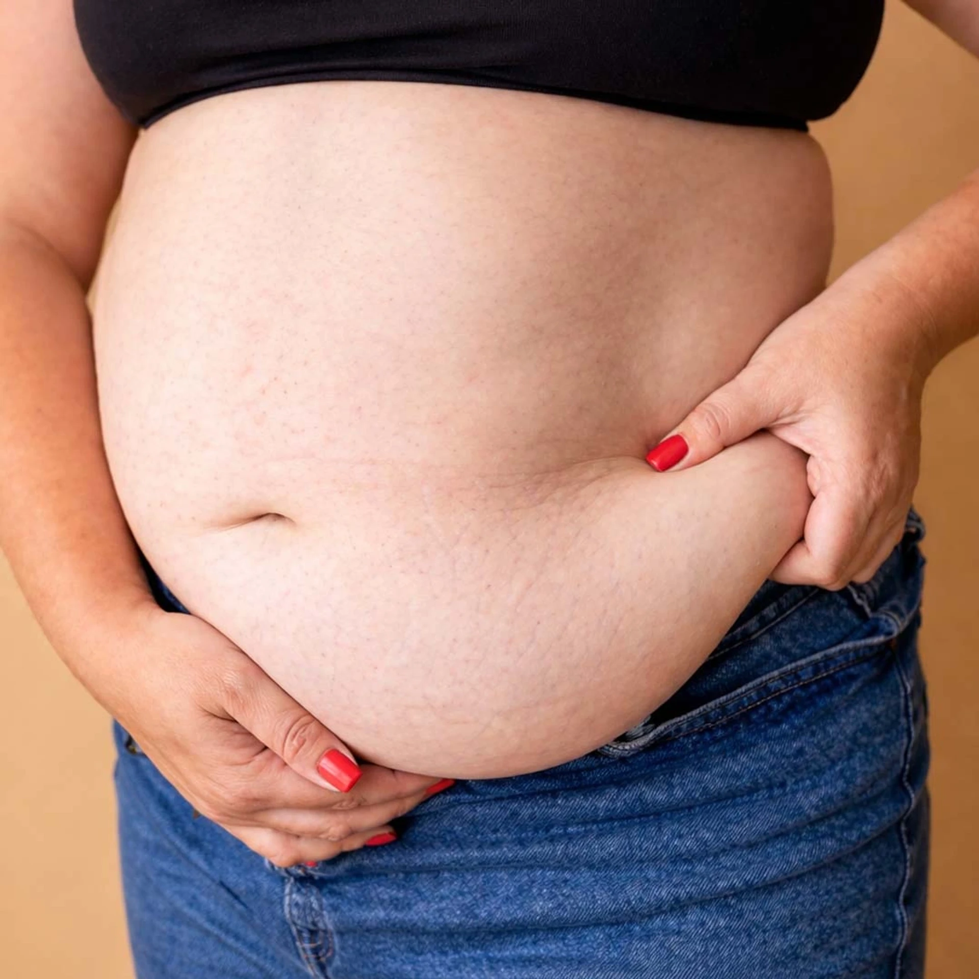 obesità-come-il-bendaggio-gastrico-aiuta-i-pazienti-a-perdere-peso