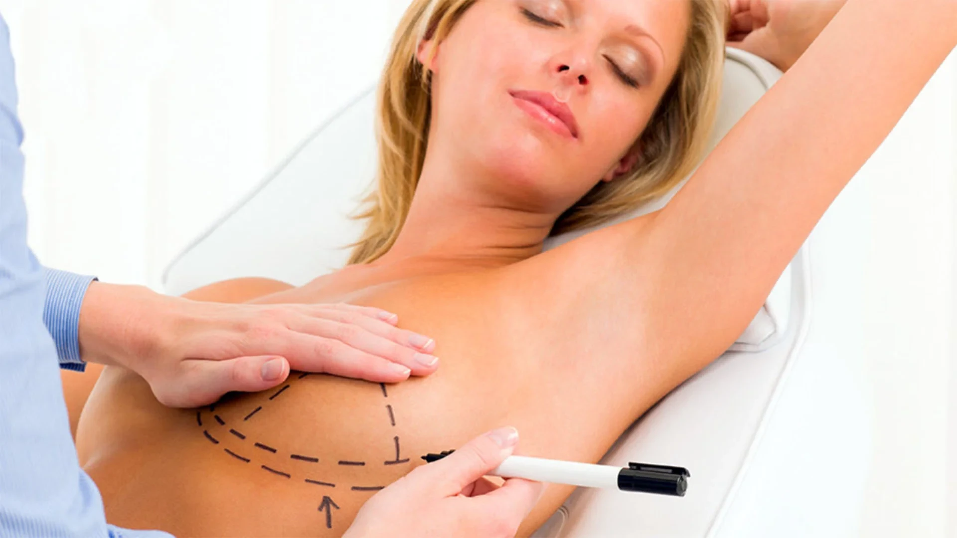 post-terapia e recupero-riduzione del seno