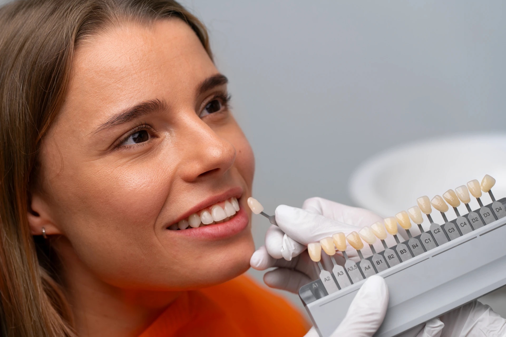 faccette-dentali-turchia