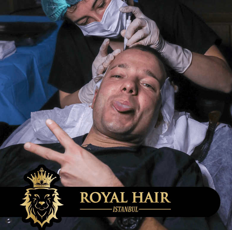 Understanding Hair Transplant Success Rates: Factors and Expectations