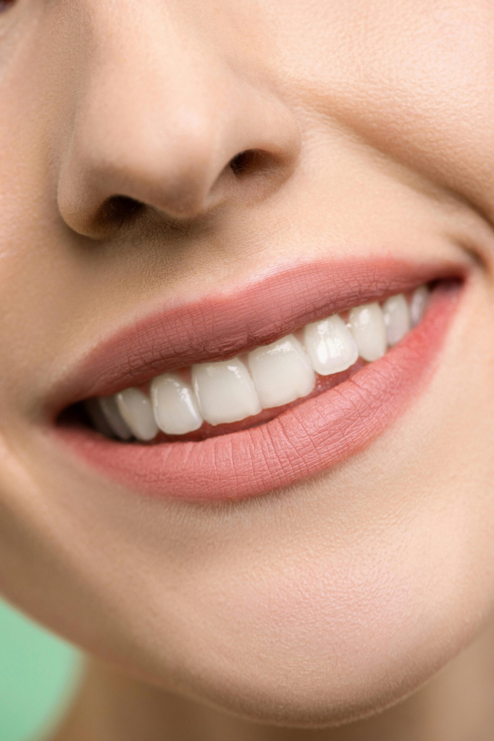 Teeth Whitening in Albania: Brighten Your Smile Affordably