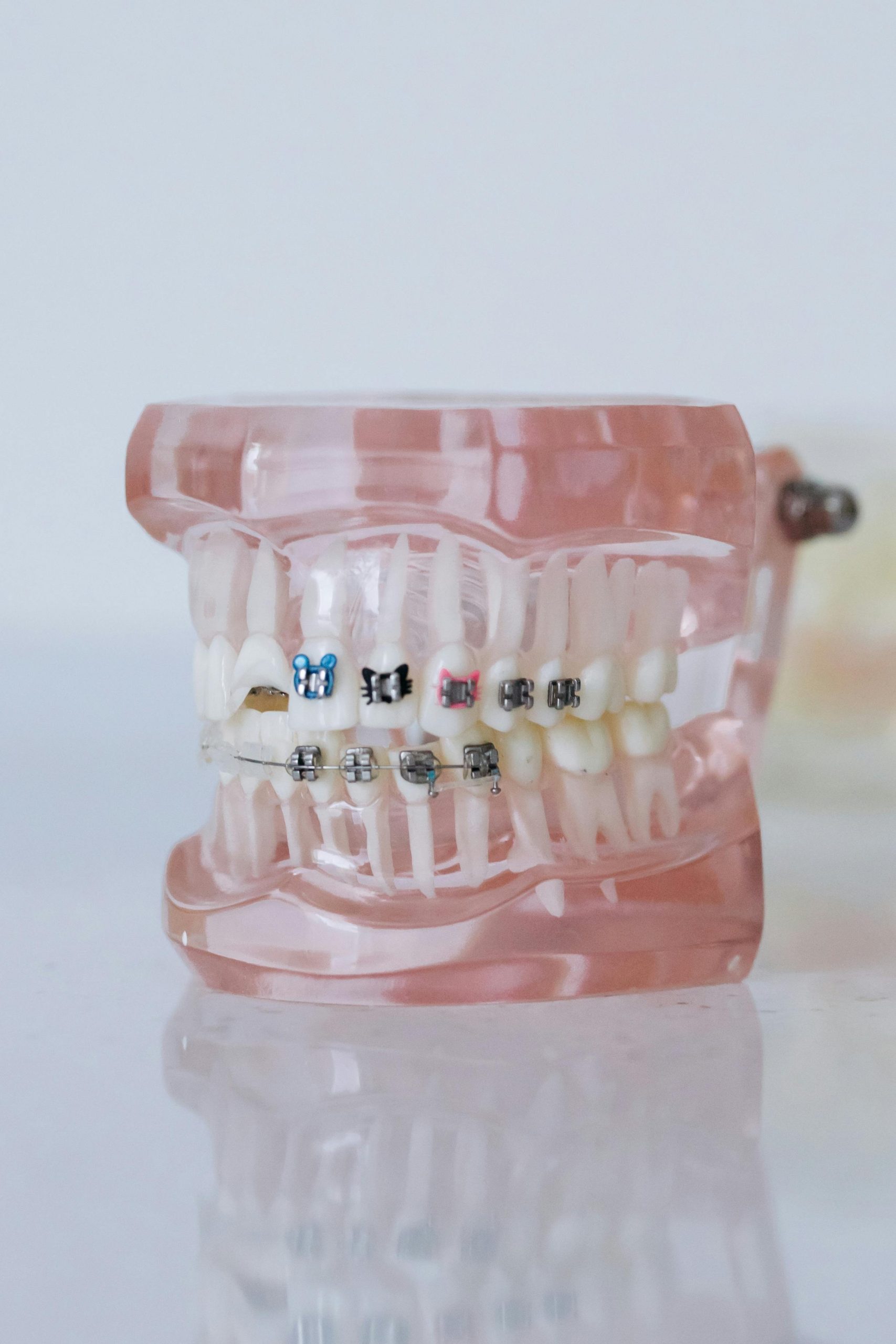 Discover affordable, high-quality orthodontics in Albania. Straighten your smile with expert care at competitive prices.